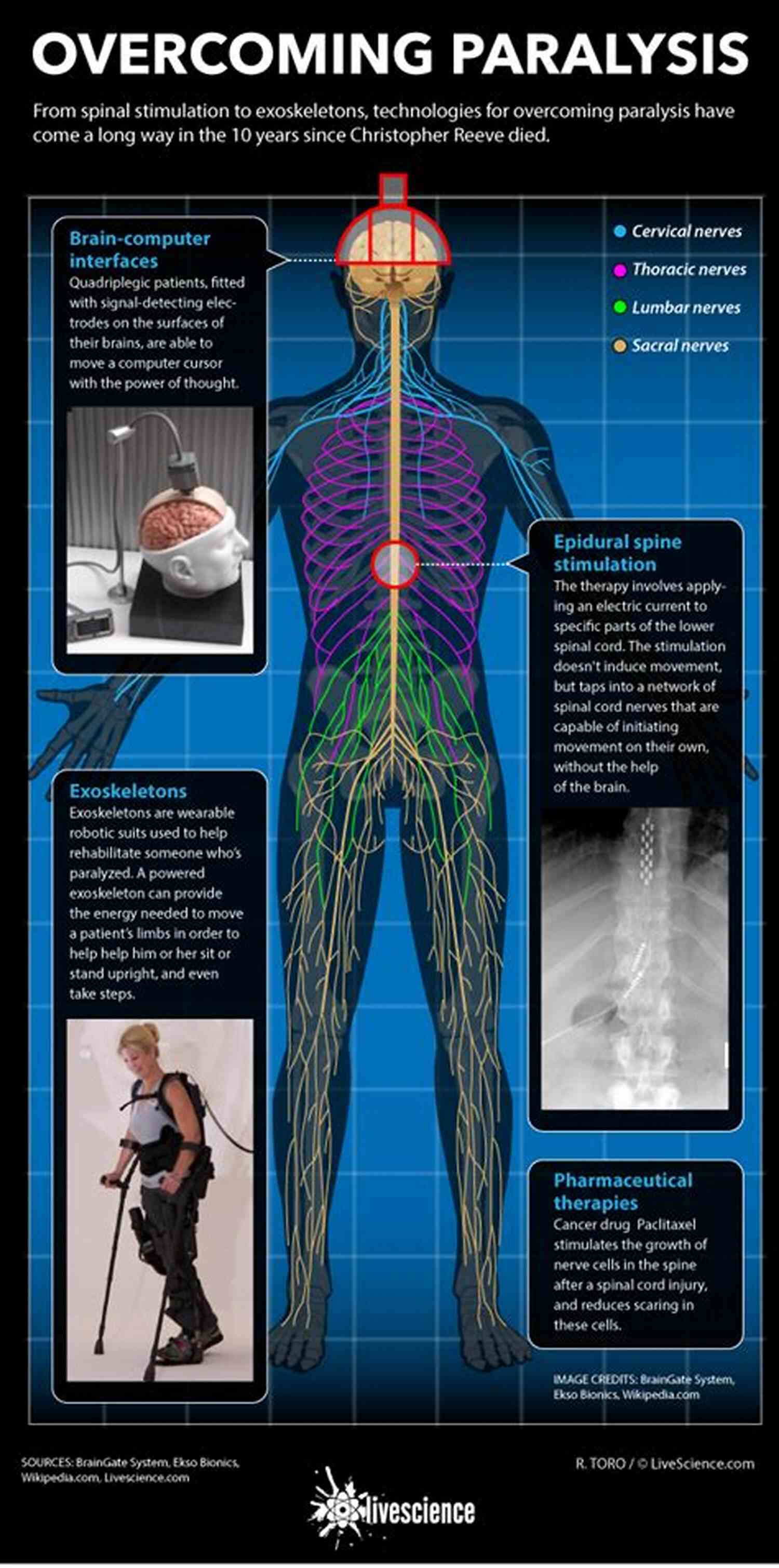 Paralyzed In Pain The Play Poster Paralyzed In Pain: The Play